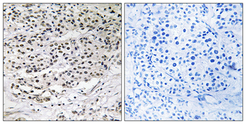 AZI1 Antibody