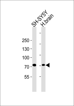 ARPP21 Antibody