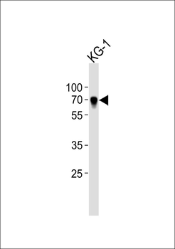 IKZF2 Antibody