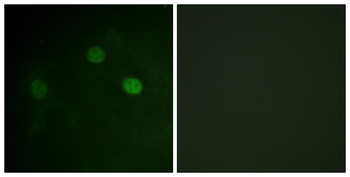 CDK1/CDC2 (Phospho-Thr14) Antibody