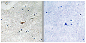 VE-Cadherin (Phospho-Tyr731) Antibody