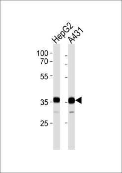 TFDP2 Antibody