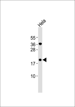 Claudin 4 Antibody
