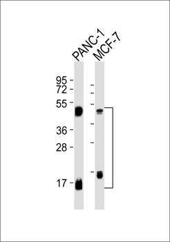 Cathepsin D LC Antibody