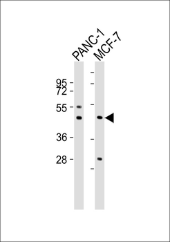 Cathepsin D HC Antibody