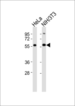 KLF11 Antibody