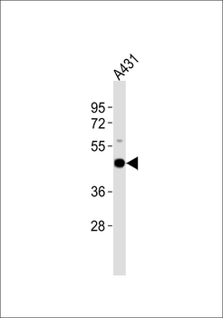 Cytokeratin 18 Antibody