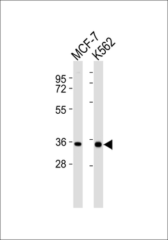 MRPL15 Antibody