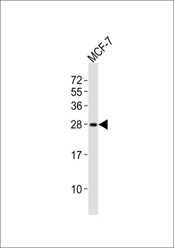 RAB20 Antibody