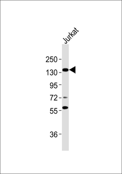 RB2 Antibody