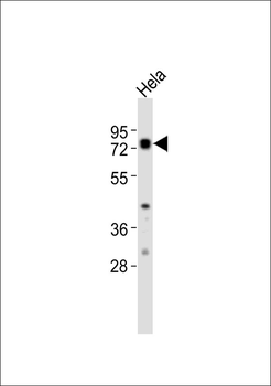Radixin Antibody