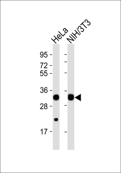 RPS2 Antibody