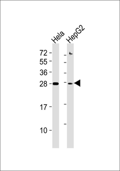 TP53INP1 Antibody