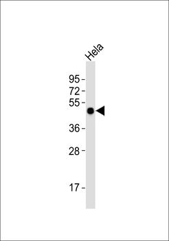 TUSC3 Antibody