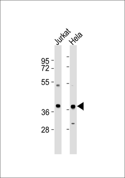 AMPK gamma 1 Antibody