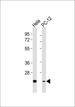 CHAC1 Antibody