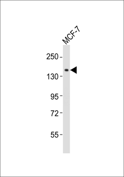 NACAD Antibody