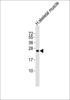 CACNG1 Antibody