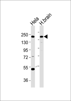 YEATS2 Antibody