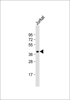 FAM84B Antibody