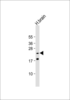 SCN4B Antibody