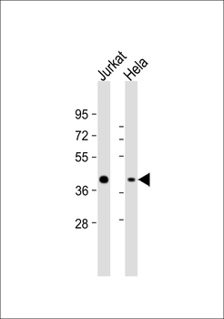 MAPKAPK3 Antibody