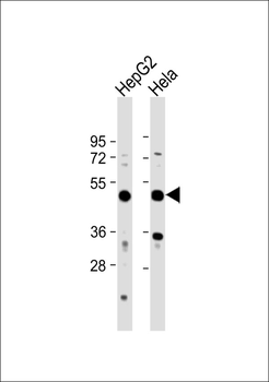 RSAD1 Antibody