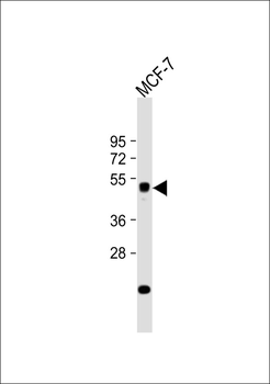 ZFYVE19 Antibody
