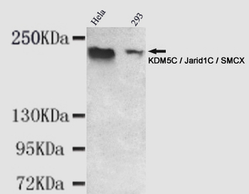 KDM5C / Jarid1C / SMCX Antibody