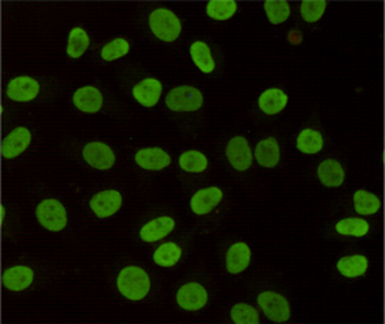 HP1-gamma Antibody