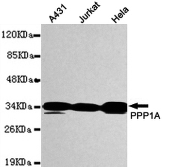 PPP1A Antibody