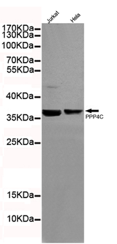 Protein Phosphatase 4C Antibody