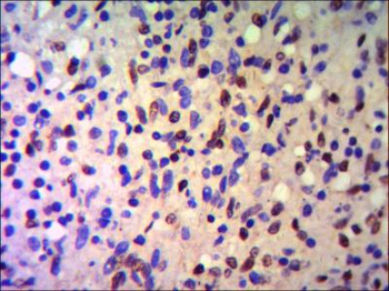 KAP1 / TIF1 beta Antibody