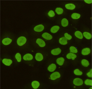 KAP1 / TIF1 beta Antibody
