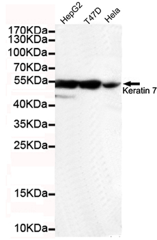 Keratin 7 (C-terminus) Antibody
