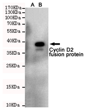 Cyclin D2 Antibody
