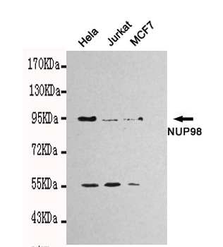 NUP98 Antibody