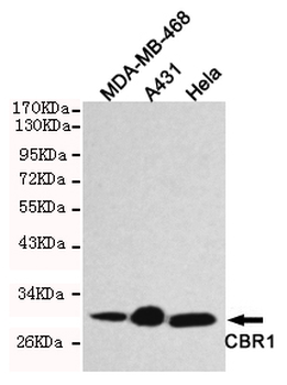 CBR1 Antibody