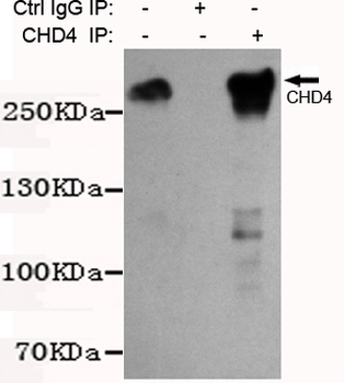 CHD4 Antibody