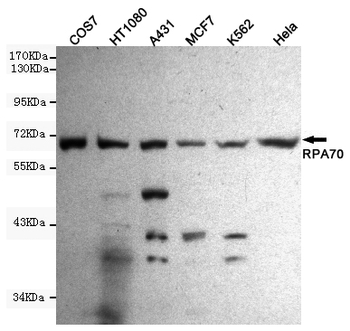 RPA70 Antibody