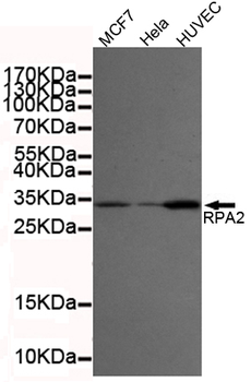 RPA32/RPA2 Antibody
