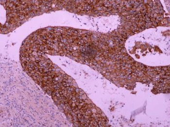 EGF Receptor Antibody