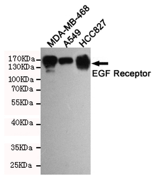 EGF Receptor Antibody