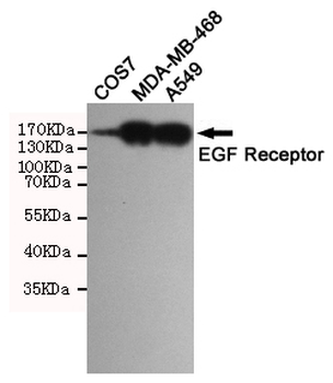 EGF Receptor Antibody