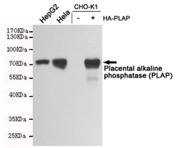 Placental alkaline phosphatase (PLAP) Antibody