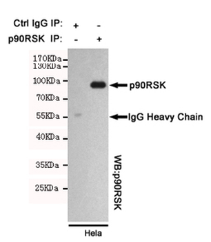 p90RSK Antibody