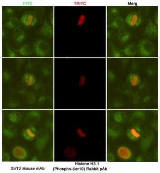 Anti-SirT2 Antibody