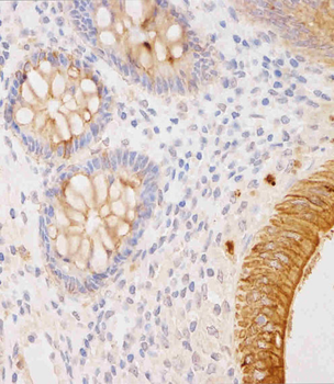 Cytokeratin 18 Mouse mAb Antibody