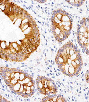 CK19 Mouse mAb Antibody