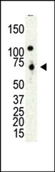 PRMT4 Antibody (C-term)